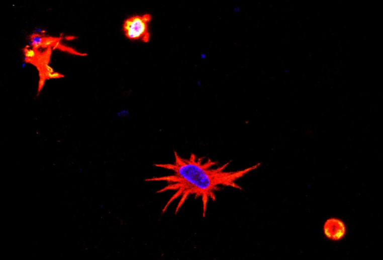 Grupo da Unifesp desenvolve protocolo para impressão 3D de células cerebrais