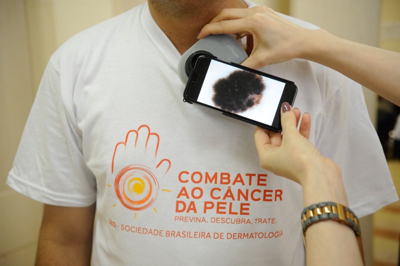 Guia procura esclarecer relação entre covid-19 e lesões de pele