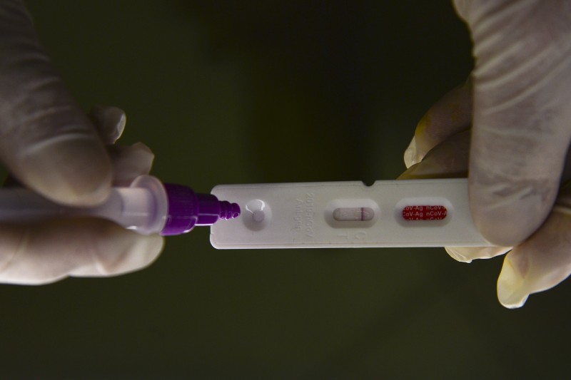 Brasil registra 27.796 casos e 114 mortes em 24 horas